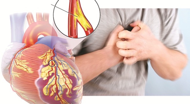 gặp 8 dấu hiệu này, có thể bạn đã mắc bệnh tim