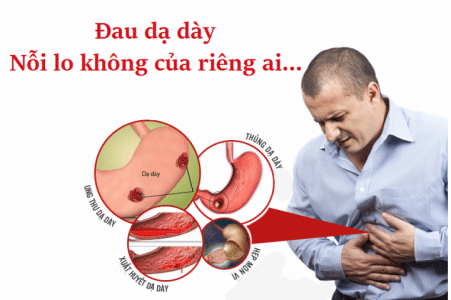 nguyen nhan gay dau da day khong chi do an uong