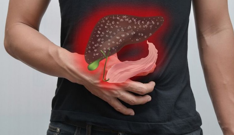 Gan Nhiễm Mỡ Nên Ăn Gì, Không Nên Ăn Gì? 3 gan nhiễm mỡ nên ăn gì, không nên ăn gì?