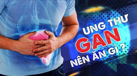 ung thu gan nen an gi 2