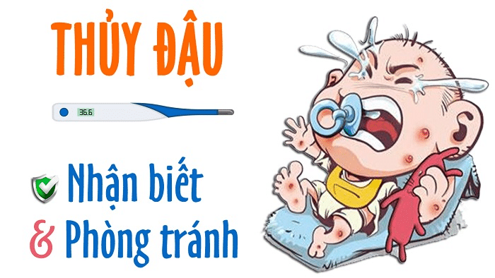 Thủy Đậu – Nguyên Nhân Và Cách Điều Trị 2 bệnh thủy đậu