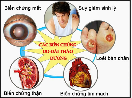 Nhiễm Covid-19 Ở Bệnh Nhân Đái Tháo Đường 4 nhiễm covid-19 ở bệnh nhân đái tháo đường