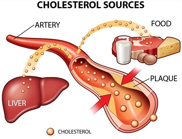 Cách Làm Giảm Cholesterol Tại Nhà 6 cách làm giảm cholesterol