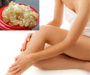 6 Cách Tẩy Lông Tại Nhà Hiệu Quả, Nhanh Chóng Và An Toàn! 10 cách triệt lông tại nhà bằng mỡ trăn