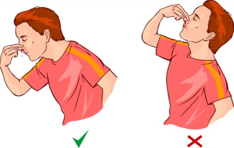 chảy máu cam ở người lớn 11